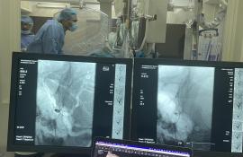 O echipă multidisciplinară de la IMU a salvat viața unui pacient de 25 de anidiagnosticat cu hemoragie subarahnoidiană