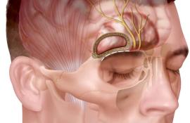 Medicii neurochirurgi de la IMU au salvat vederea unui pacient depistat cu tumoră de tubercul selar